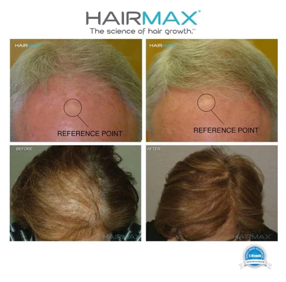 HairMax comfort - flex LaserBand 82 - Elegant Beauty - HairMax