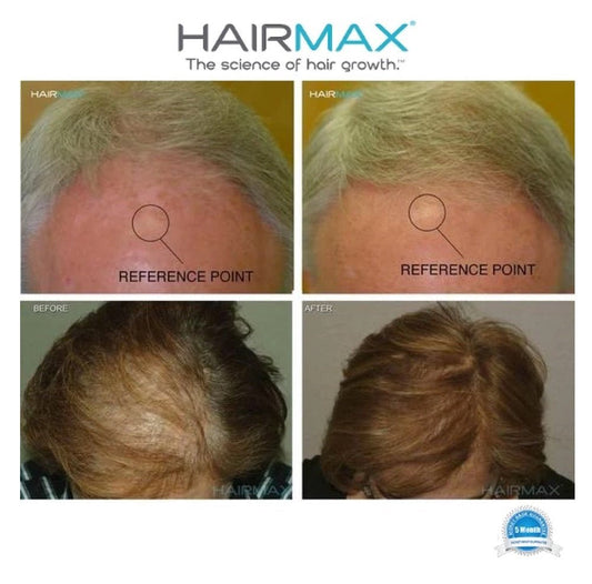 HairMax comfort - flex LaserBand 82 - Elegant Beauty - HairMax