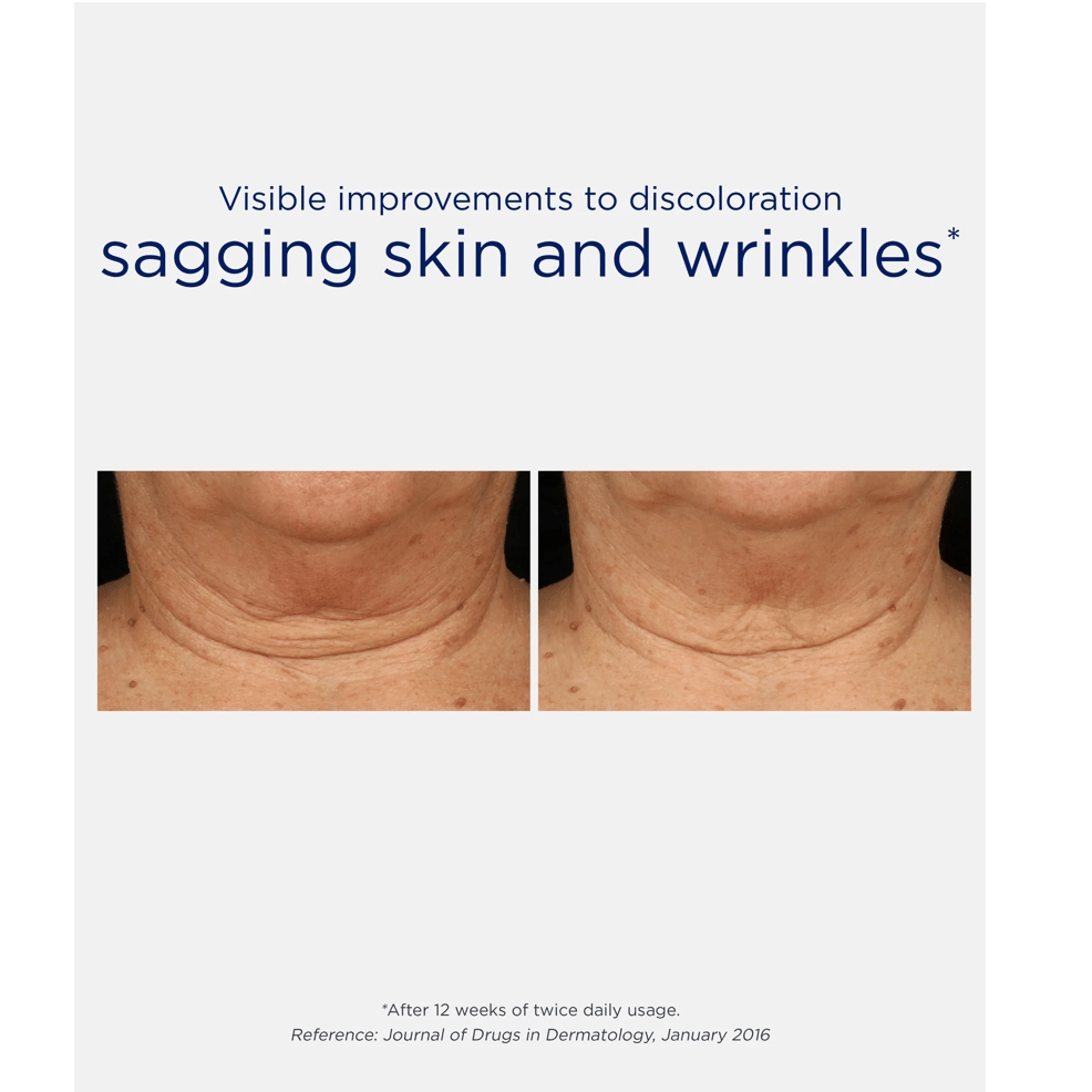 NeoStrata Skin Active Triple Firming Neck Cream - Elegant Beauty - NeoStrata