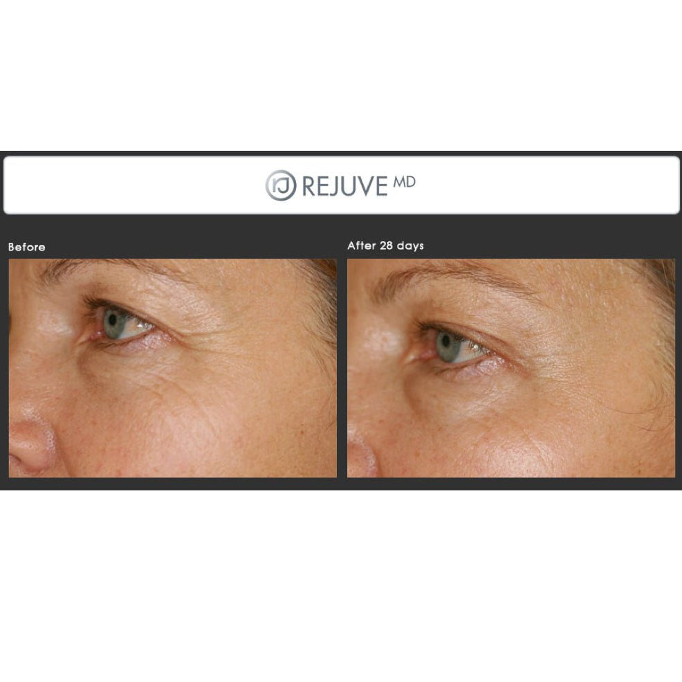 Rejuve MD Anti - aging Eye Serum - Elegant Beauty - Rejuve MD