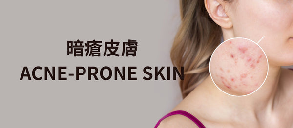 Acne-prone Skin