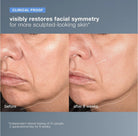 dermalogica neurotouch symmetry serum - Elegant Beauty - dermalogica