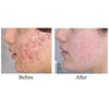 (Member Exclusive) Sample iS Clinical Pro-Heal Serum Advance+ (3.75mL x 10) - Elegant Beauty-Elegant Beauty