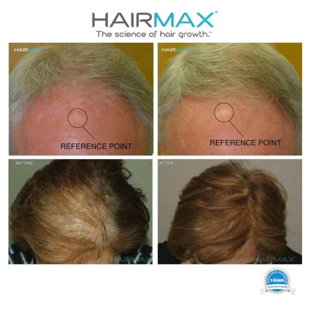 HairMax comfort-flex LaserBand 41 - Elegant Beauty-HairMax