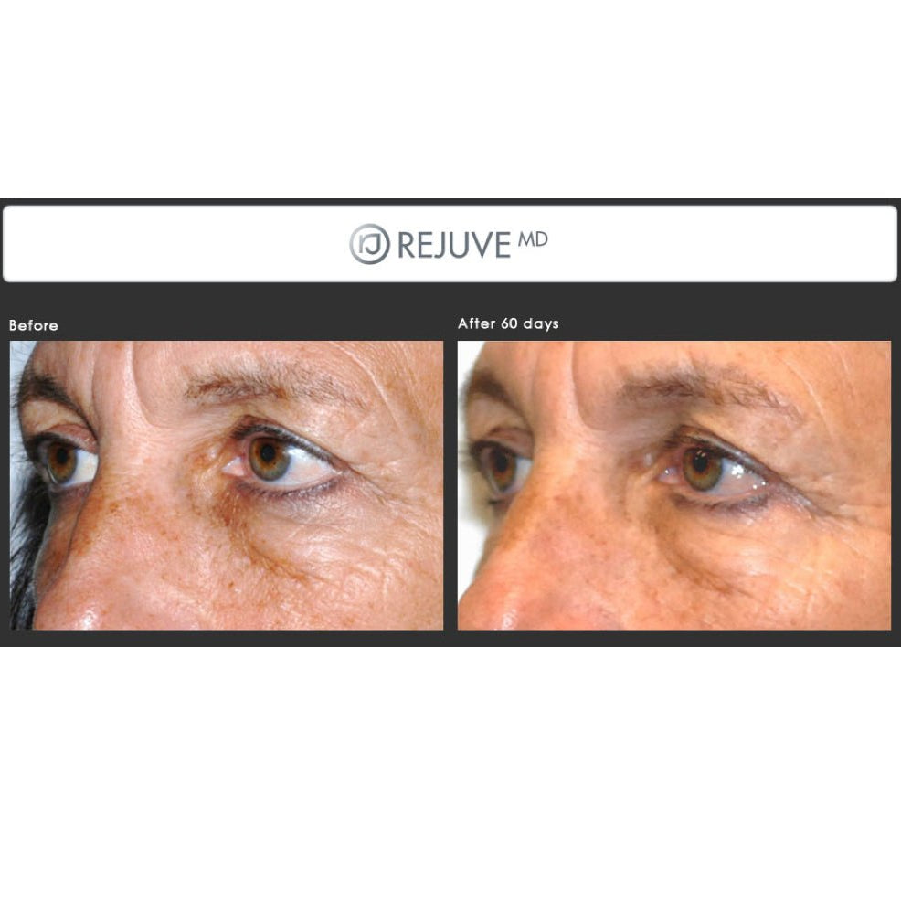 Rejuve MD Anti-aging Eye Serum - Elegant Beauty-Rejuve MD