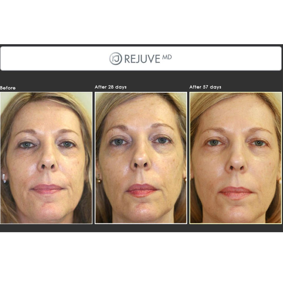 Rejuve MD Anti-aging Face Serum - Elegant Beauty-Rejuve MD